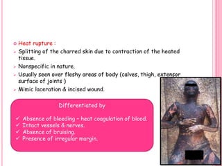  Heat rupture :
 Splitting of the charred skin due to contraction of the heated
tissue.
 Nonspecific in nature.
 Usually seen over fleshy areas of body (calves, thigh, extensor
surface of joints )
 Mimic laceration & incised wound.
Differentiated by
 Absence of bleeding – heat coagulation of blood.
 Intact vessels & nerves.
 Absence of bruising.
 Presence of irregular margin.
49
 