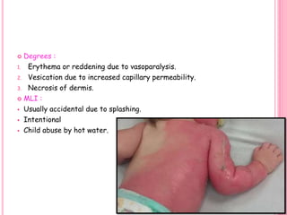  Degrees :
1. Erythema or reddening due to vasoparalysis.
2. Vesication due to increased capillary permeability.
3. Necrosis of dermis.
 MLI :
 Usually accidental due to splashing.
 Intentional
 Child abuse by hot water.
56
 
