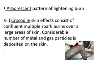 • Arborescent pattern of lightening burn
.
•iii).Crocodile skin effects consist of
confluent multiple spark burns over a
large areas of skin. Considerable
number of metal and gas particles is
deposited on the skin.
.
 