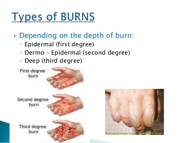thermal injury thermal injury