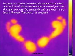 IR involves four bands: 