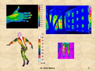  The Greek physician Hippocrates wrote, In whatever part of the body excess of heat or cold is felt, the disease is there to be discovered.4Dr. Nidhi Mathur