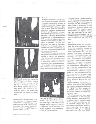 Thermography for psychogenic pain