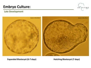 The role of assisted reproductive techniques (art’s) in building a ...