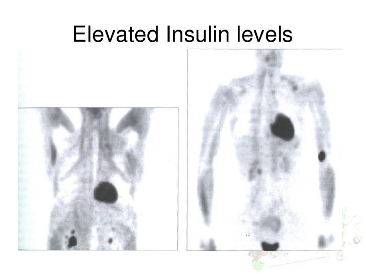 The role of blood sugar levels and insulin in pet