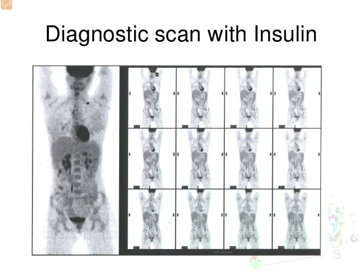The role of blood sugar levels and insulin in pet