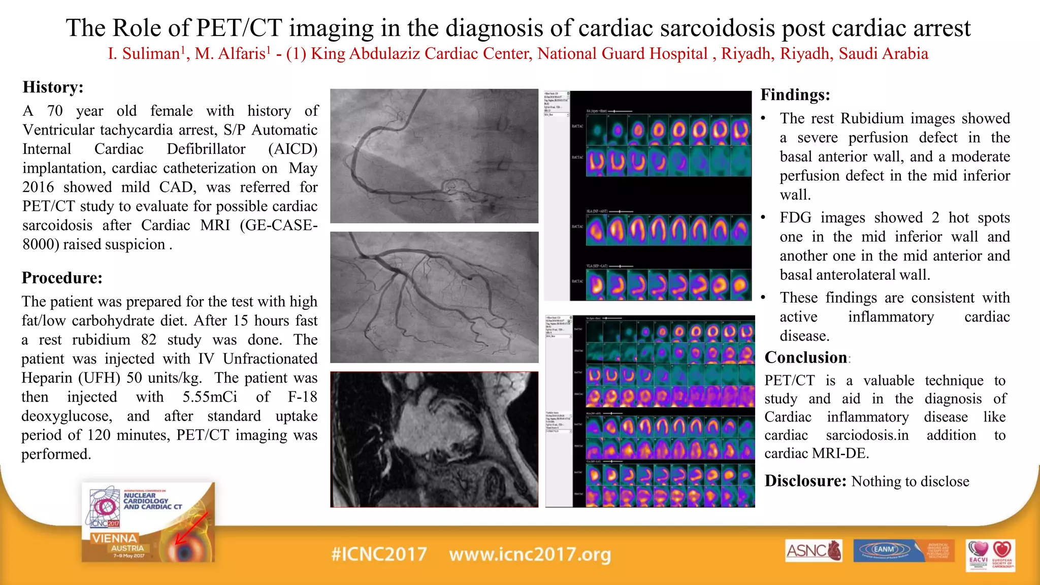 The Role of PET-CT imaging in the diagnosis of cardiac sarcoidosis post ...