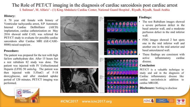 The Role of PET-CT imaging in the diagnosis of cardiac sarcoidosis post ...