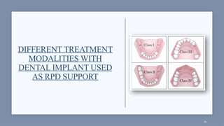 Dental Rp Classification The Role of the Dental Implant in RPD_JC.pptx
