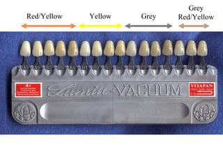 Red/Yellow Yellow Grey Grey Red/Yellow 