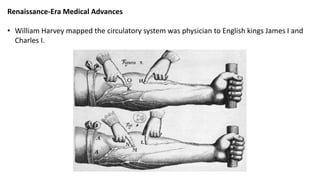 Renaissance-Era Medical Advances
• William Harvey mapped the circulatory system was physician to English kings James I and
Charles I.
 