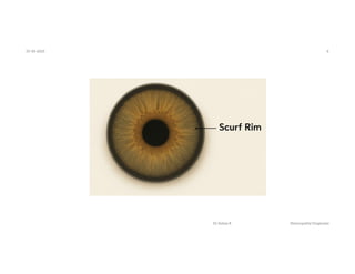 Scurf Rim Vs Regular Rim The Scurf Rim - Naturopathy Diagnosis .pdf