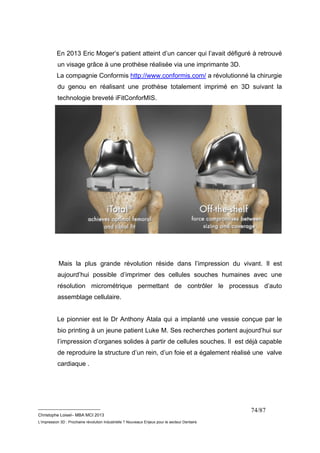 En 2013 Eric Moger’s patient atteint d’un cancer qui l’avait défiguré à retrouvé 
un visage grâce à une prothèse réalisée via une imprimante 3D. 
La compagnie Conformis http://www.conformis.com/ a révolutionné la chirurgie 
du genou en réalisant une prothèse totalement imprimé en 3D suivant la 
technologie breveté iFitConforMIS. 
Mais la plus grande révolution réside dans l’impression du vivant. Il est 
aujourd’hui possible d’imprimer des cellules souches humaines avec une 
résolution micrométrique permettant de contrôler le processus d’auto 
assemblage cellulaire. 
Le pionnier est le Dr Anthony Atala qui a implanté une vessie conçue par le 
bio printing à un jeune patient Luke M. Ses recherches portent aujourd’hui sur 
l’impression d’organes solides à partir de cellules souches. Il est déjà capable 
de reproduire la structure d’un rein, d’un foie et a également réalisé une valve 
cardiaque . 
__________________________ 
Christophe Loisel– MBA MCI 2013 
L’impression 3D : Prochaine révolution Industrielle ? Nouveaux Enjeux pour le secteur Dentaire 
74/87 
 