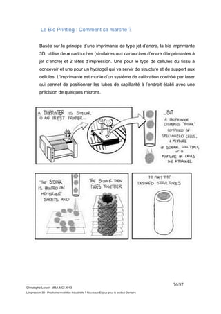 __________________________ 
Christophe Loisel– MBA MCI 2013 
L’impression 3D : Prochaine révolution Industrielle ? Nouveaux Enjeux pour le secteur Dentaire 
76/87 
Le Bio Printing : Comment ca marche ? 
Basée sur le principe d’une imprimante de type jet d’encre, la bio imprimante 
3D utilise deux cartouches (similaires aux cartouches d’encre d’imprimantes à 
jet d’encre) et 2 têtes d’impression. Une pour le type de cellules du tissu à 
concevoir et une pour un hydrogel qui va servir de structure et de support aux 
cellules. L’imprimante est munie d’un système de calibration contrôlé par laser 
qui permet de positionner les tubes de capillarité à l’endroit établi avec une 
précision de quelques microns. 
 