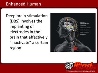 Usenet    Wikis    ICQ  Friendster    LinkedIn    MySpace    Facebook    Twitter Enhanced Human Deep brain stimulation (DBS) involves the implanting of electrodes in the brain that effectively “inactivate” a certain region. 