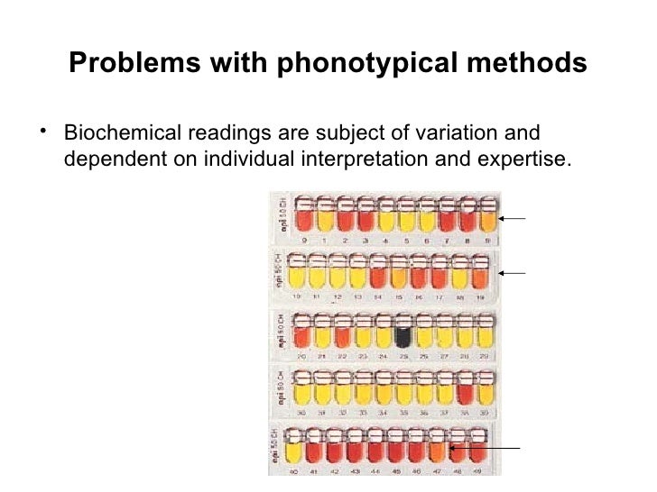 rapd pcr thesis Plant genetics research article comparison of rapd, rflp, aflp and ssr markers for diversity studies in tropical maize inbred lines. rapd pcr thesis Plant genetics research article comparison of rapd, rflp, aflp and ssr markers for diversity studies in tropical maize inbred lines.