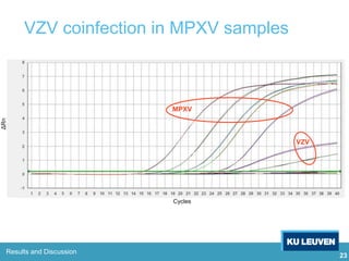 23
Results and Discussion
VZV
MPXV
VZV coinfection in MPXV samples
 