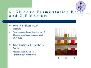 5. Glucose Fermentation Broth and O/F Medium Tube 1& 2: Glucose O/F Medium Pseudomonas shows Respiration of Glucose- Acid seen in upper part of 1 st  tube Tube 3: Glucose Fermentation Broth Pseudomonas shows no fermentation of Glucose 1 2  3 
