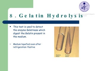 8. Gelatin Hydrolysis This test is used to detect the enzyme Gelatinase which digest the Gelatin present in the medium. Medium liquefied even after refrigeration: Positive Negative Result Positive Result 