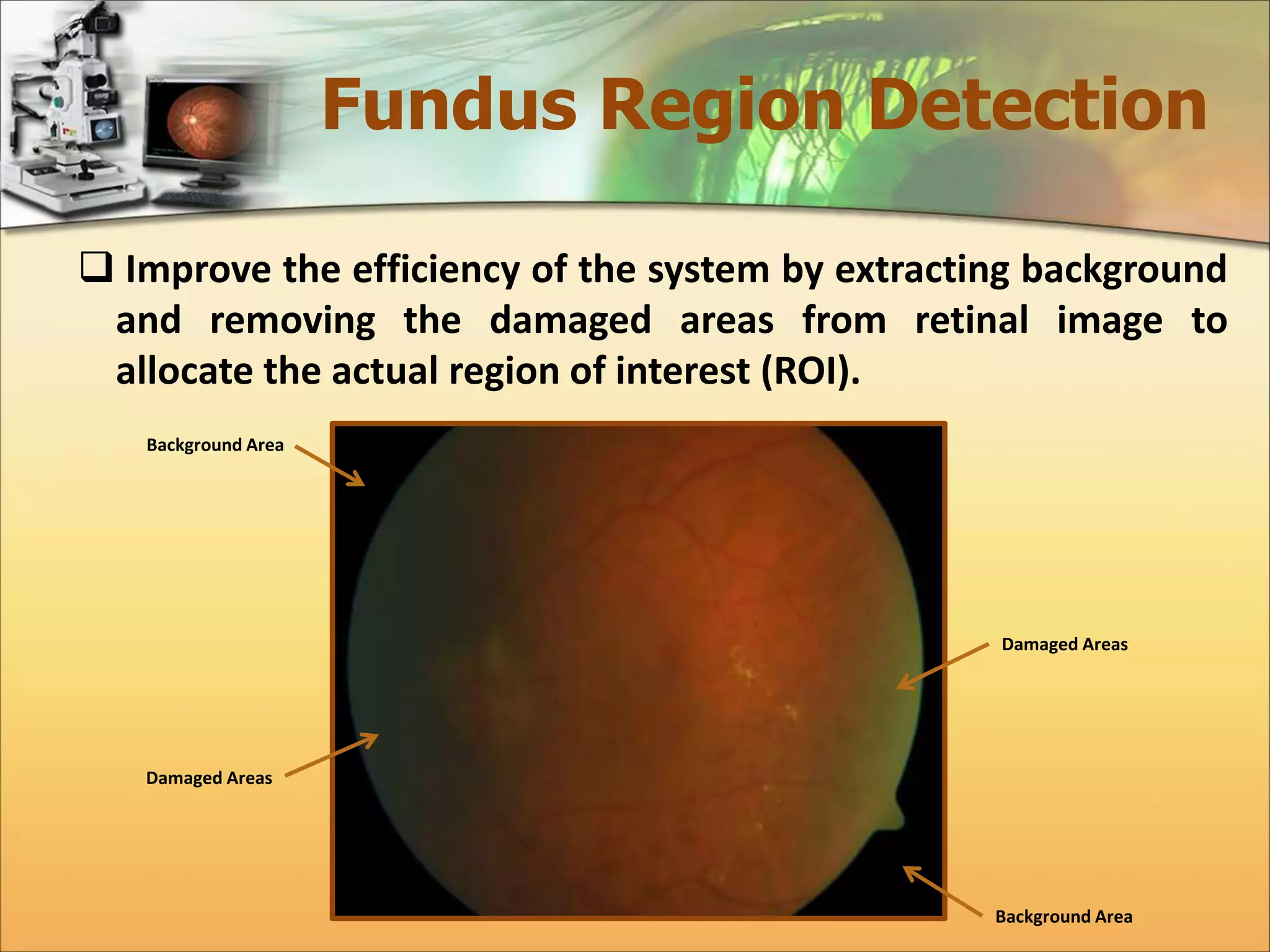 Fundus Region Detection 
 Improve the efficiency of the system by extracting background 
and removing the damaged areas from retinal image to 
allocate the actual region of interest (ROI). 
Background Area 
Background Area 
Damaged Areas 
Damaged Areas 
 