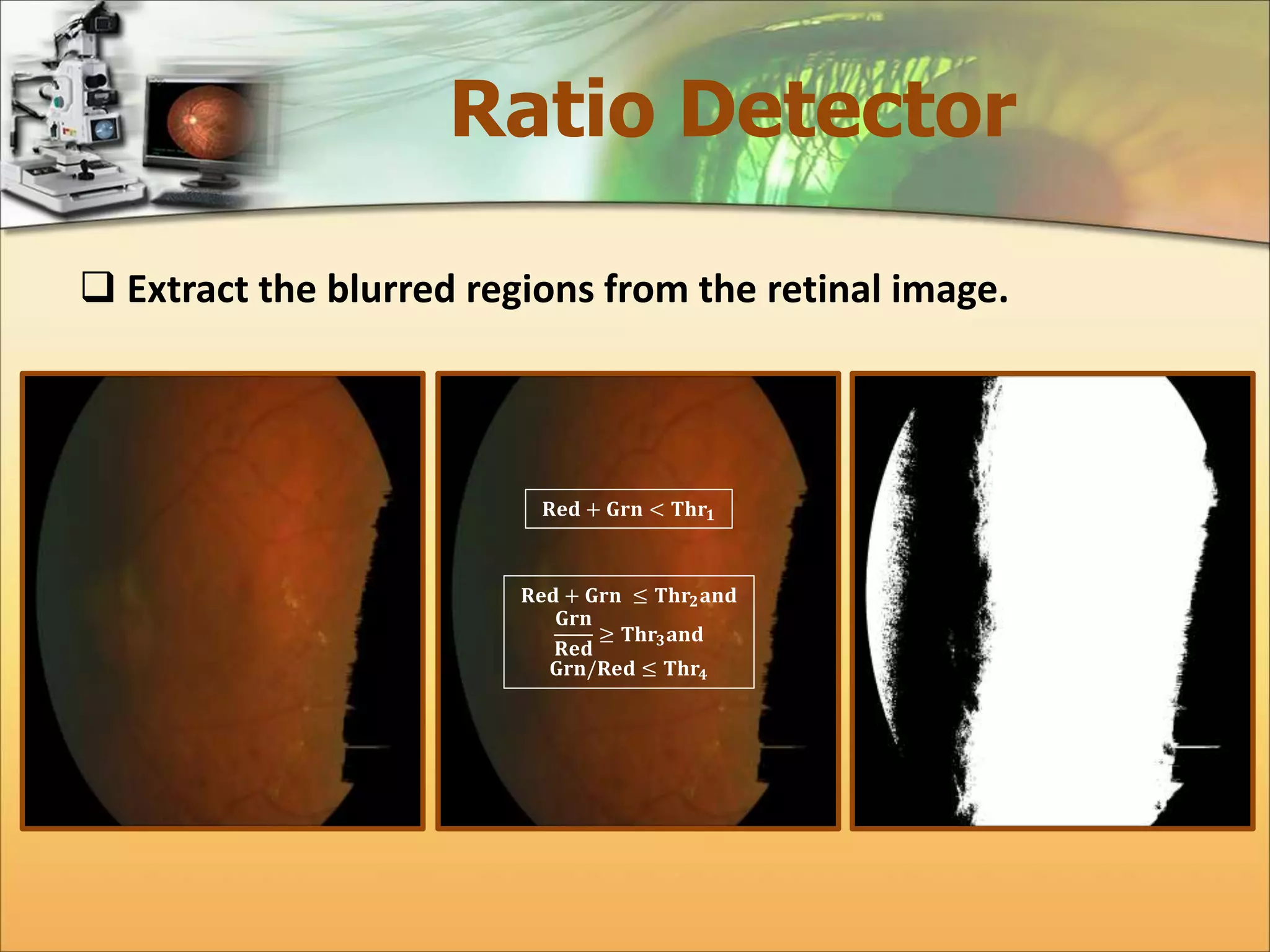 Ratio Detector 
 Extract the blurred regions from the retinal image. 
퐑퐞퐝 + 퐆퐫퐧 < 퐓퐡퐫ퟏ 
퐑퐞퐝 + 퐆퐫퐧 ≤ 퐓퐡퐫ퟐ퐚퐧퐝 
퐆퐫퐧 
퐑퐞퐝 
≥ 퐓퐡퐫ퟑ퐚퐧퐝 
퐆퐫퐧/퐑퐞퐝 ≤ 퐓퐡퐫ퟒ 
 