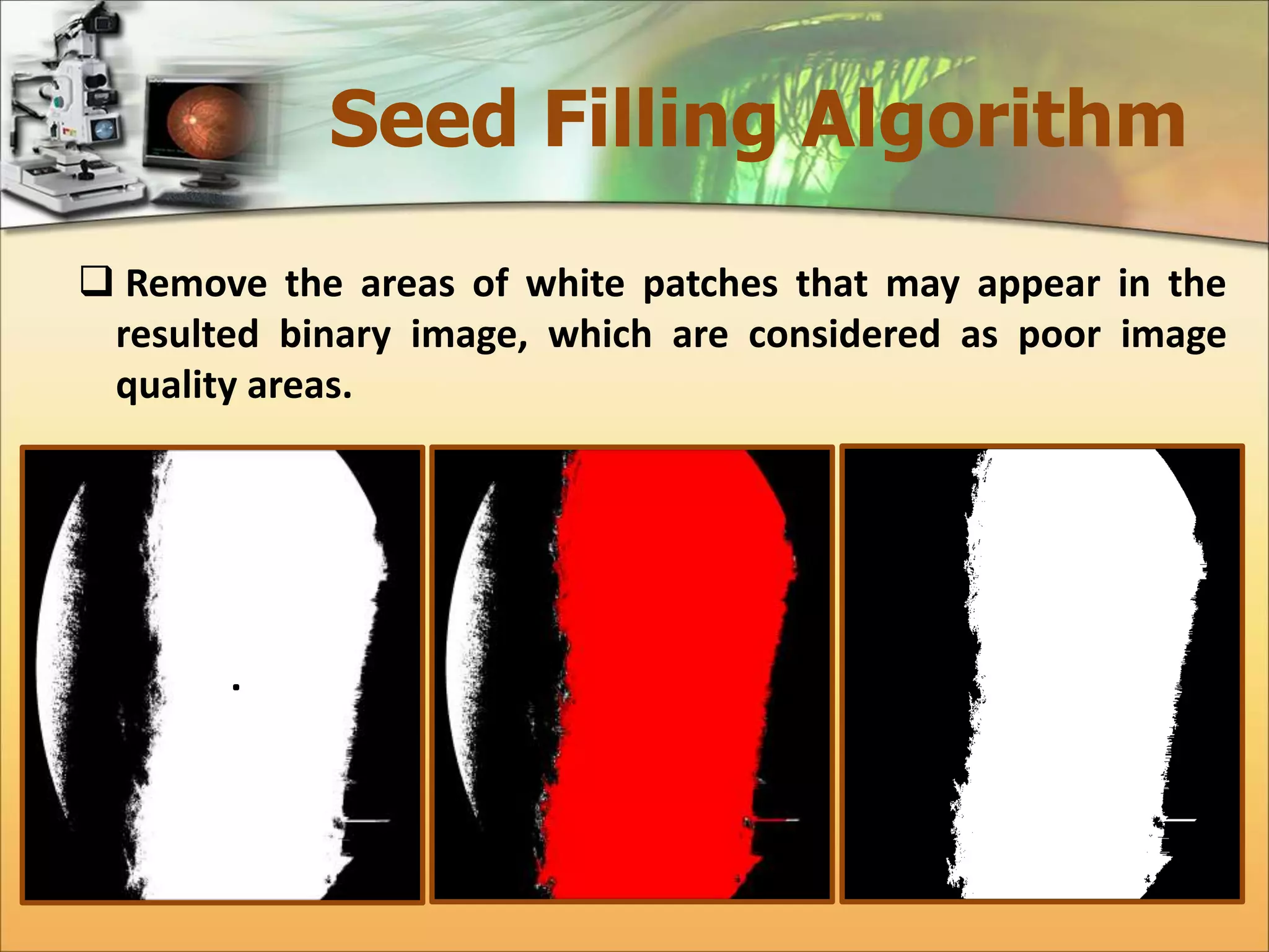 Seed Filling Algorithm 
 Remove the areas of white patches that may appear in the 
resulted binary image, which are considered as poor image 
quality areas. 
 