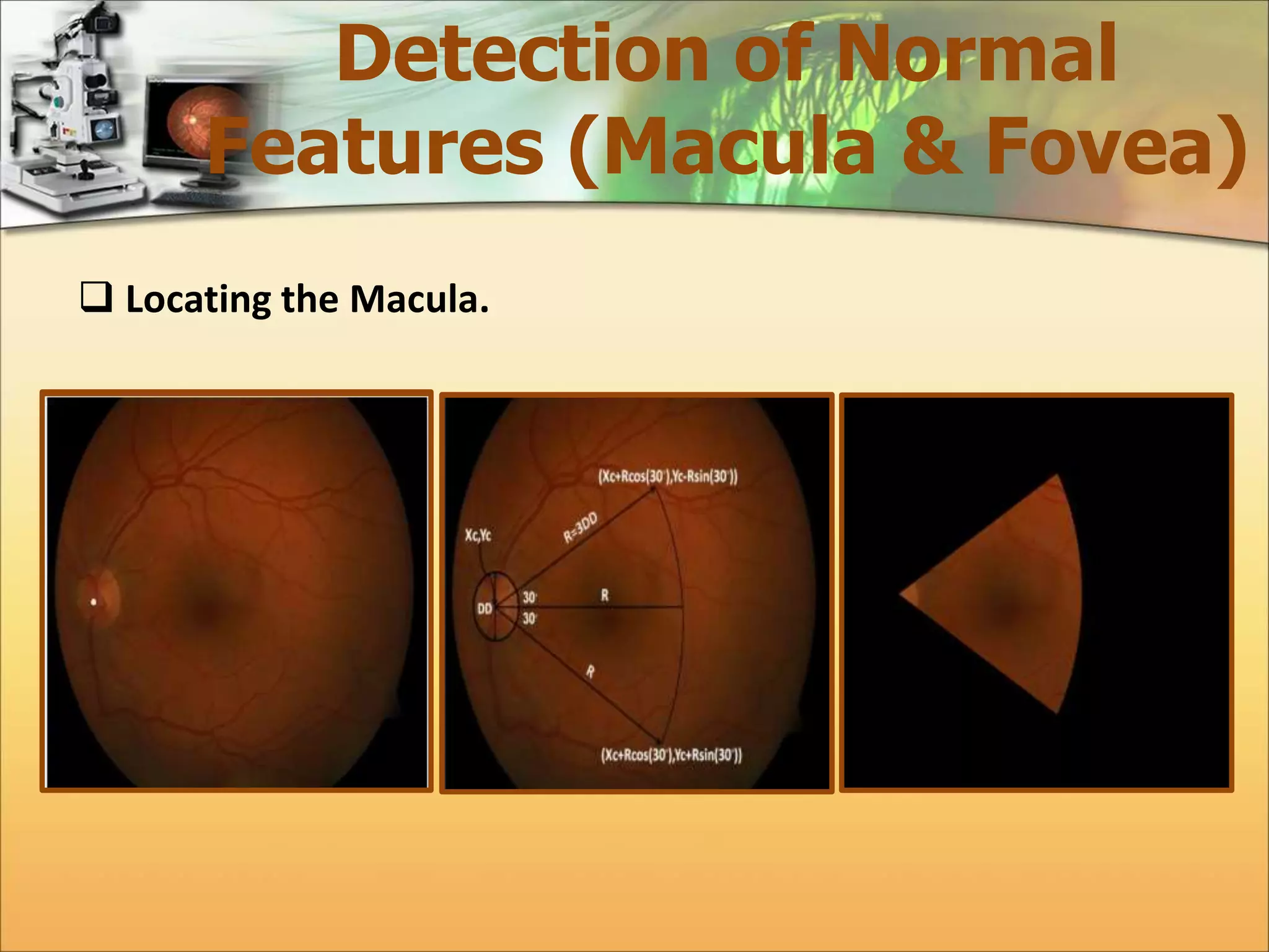 Detection of Normal 
Features (Macula & Fovea) 
 Locating the Macula. 
 