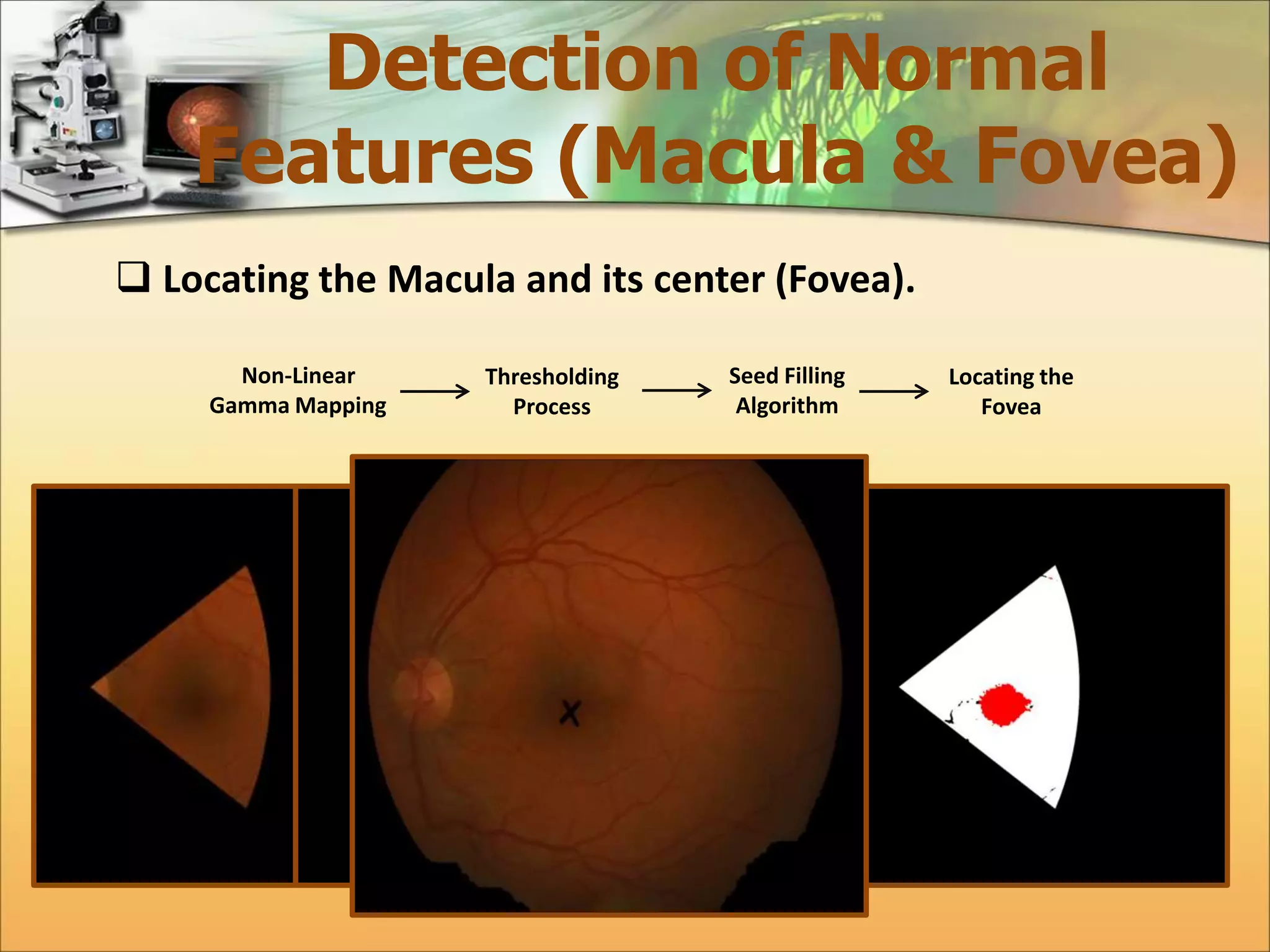 Detection of Normal 
Features (Macula & Fovea) 
 Locating the Macula and its center (Fovea). 
Non-Linear 
Gamma Mapping 
Thresholding 
Process 
Seed Filling 
Algorithm 
Locating the 
Fovea 
 
