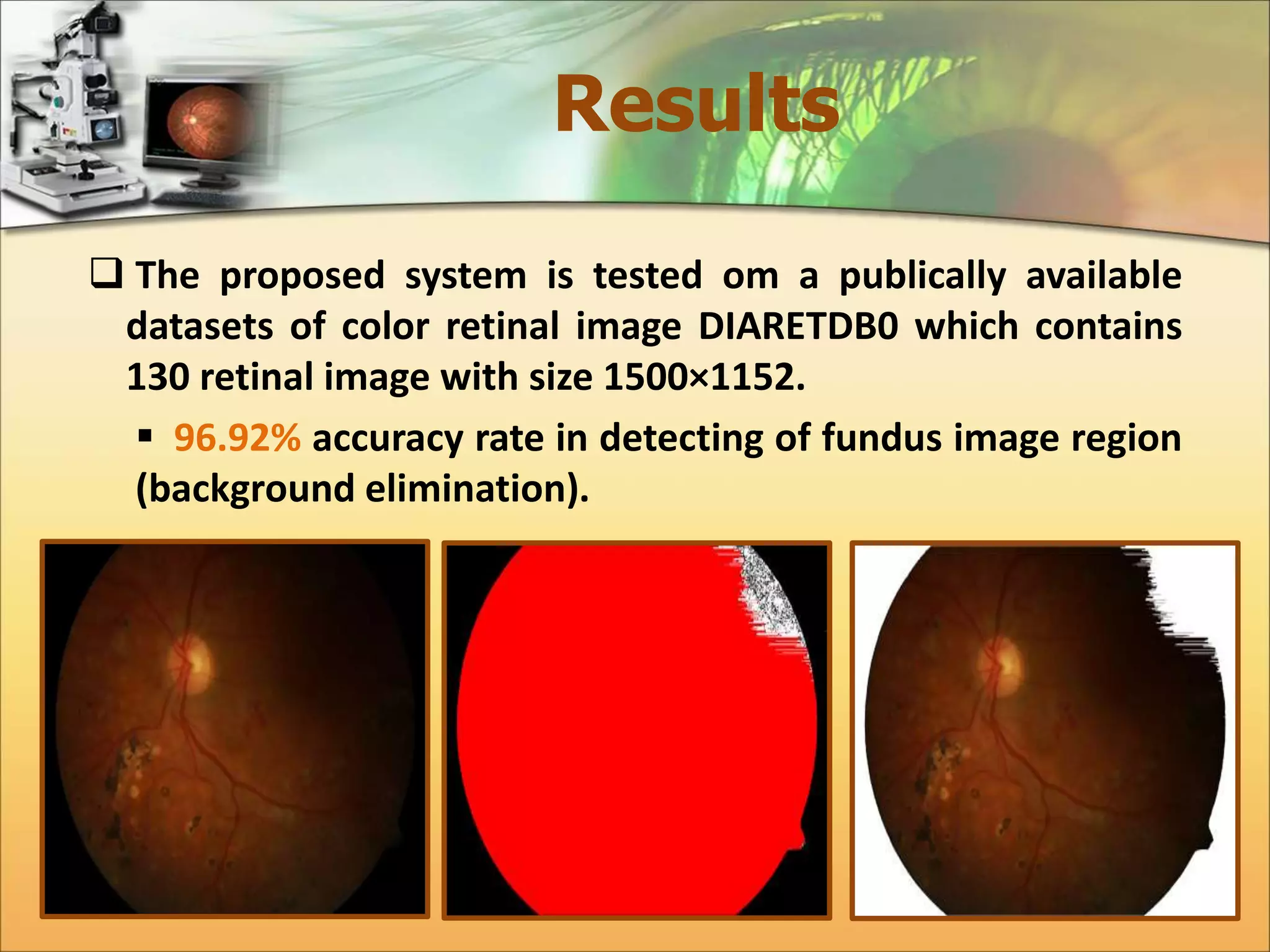 Results 
 The proposed system is tested om a publically available 
datasets of color retinal image DIARETDB0 which contains 
130 retinal image with size 1500×1152. 
 96.92% accuracy rate in detecting of fundus image region 
(background elimination). 
 
