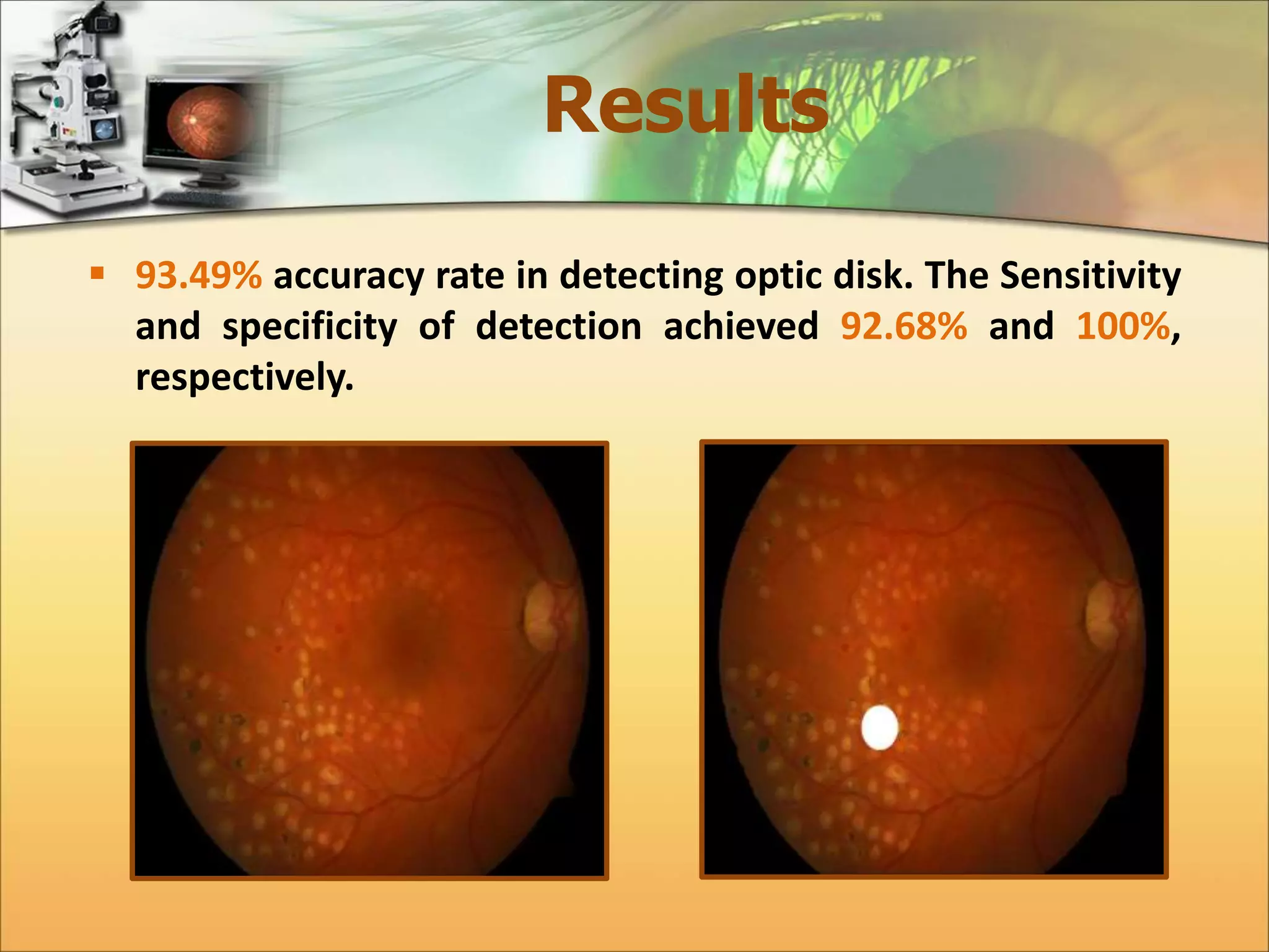 Results 
 93.49% accuracy rate in detecting optic disk. The Sensitivity 
and specificity of detection achieved 92.68% and 100%, 
respectively. 
 