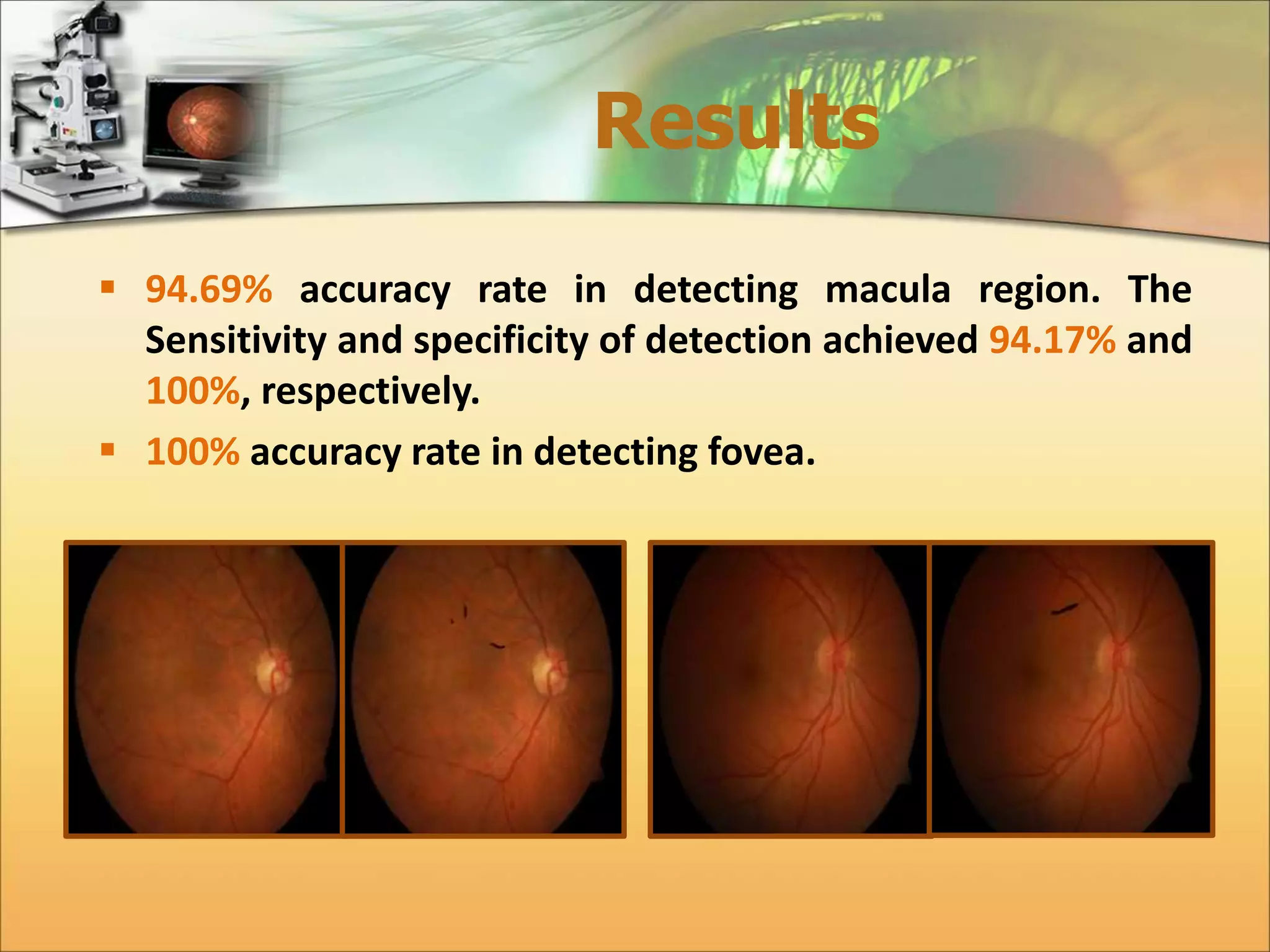 Results 
 94.69% accuracy rate in detecting macula region. The 
Sensitivity and specificity of detection achieved 94.17% and 
100%, respectively. 
 100% accuracy rate in detecting fovea. 
 