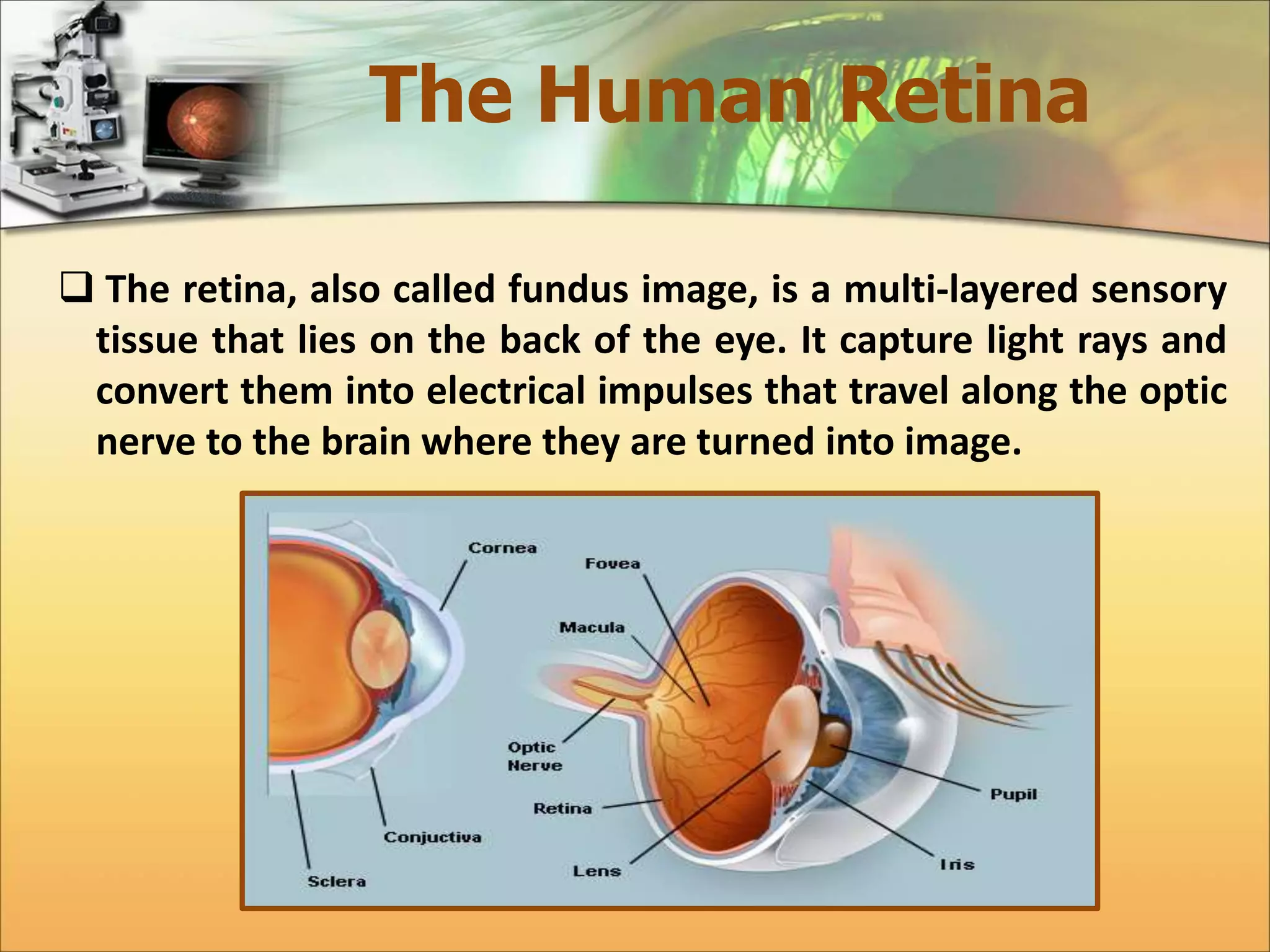 The Human Retina 
 The retina, also called fundus image, is a multi-layered sensory 
tissue that lies on the back of the eye. It capture light rays and 
convert them into electrical impulses that travel along the optic 
nerve to the brain where they are turned into image. 
 