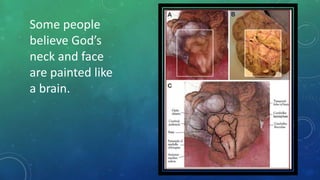 Some people
believe God’s
neck and face
are painted like
a brain.
 