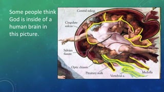 Some people think
God is inside of a
human brain in
this picture.
 