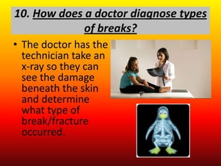 10. How does a doctor diagnose types
             of breaks?
• The doctor has the
  technician take an
  x-ray so they can
  see the damage
  beneath the skin
  and determine
  what type of
  break/fracture
  occurred.
 