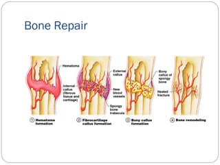 Bone Repair
 