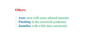 Others:
Acne seen with some adrenal tumours
Flushing in the carcinoid syndrome
Jaundice with a bile duct carcinoma
 