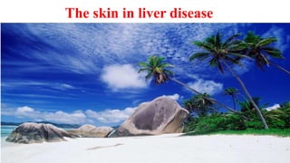 The skin in liver disease
 