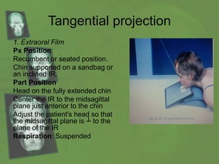 Tangential projection
1. Extraoral Film
Px Position:
Recumbent or seated position.
Chin supported on a sandbag or
an inclined IR.
Part Position
Head on the fully extended chin
Center the IR to the midsagittal
plane just anterior to the chin
Adjust the patient's head so that
the midsagittal plane is ┴ to the
plane of the IR
Respiration: Suspended
 