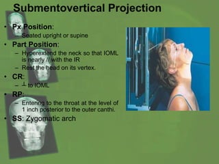 Submentovertical Projection
• Px Position:
– Seated upright or supine
• Part Position:
– Hyperextend the neck so that IOML
is nearly // with the IR
– Rest the head on its vertex.
• CR:
– ┴ to IOML
• RP:
– Entering to the throat at the level of
1 inch posterior to the outer canthi.
• SS: Zygomatic arch
 