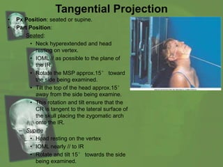 Tangential Projection
• Px Position: seated or supine.
• Part Position:
– Seated:
• Neck hyperextended and head
resting on vertex.
• IOML // as possible to the plane of
the IR.
• Rotate the MSP approx.15° toward
the side being examined.
• Tilt the top of the head approx.15°
away from the side being examine.
• This rotation and tilt ensure that the
CR is tangent to the lateral surface of
the skull placing the zygomatic arch
onto the IR.
– Supine
• Head resting on the vertex
• IOML nearly // to IR
• Rotate and tilt 15° towards the side
being examined.
 