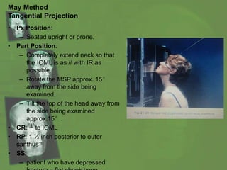 May Method
Tangential Projection
• Px Position:
– Seated upright or prone.
• Part Position:
– Completely extend neck so that
the IOML is as // with IR as
possible.
– Rotate the MSP approx. 15°
away from the side being
examined.
– Tilt the top of the head away from
the side being examined
approx.15°.
• CR: ┴ to IOML
• RP: 1 ½ inch posterior to outer
canthus
• SS:
– patient who have depressed
 