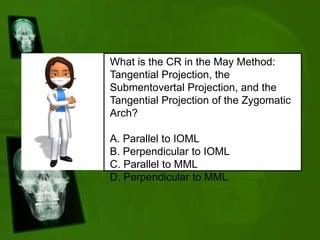 What is the CR in the May Method:
Tangential Projection, the
Submentovertal Projection, and the
Tangential Projection of the Zygomatic
Arch?
A. Parallel to IOML
B. Perpendicular to IOML
C. Parallel to MML
D. Perpendicular to MML
 