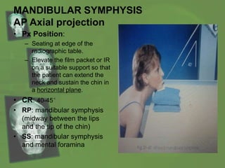 MANDIBULAR SYMPHYSIS
AP Axial projection
• Px Position:
– Seating at edge of the
radiographic table.
– Elevate the film packet or IR
on a suitable support so that
the patient can extend the
neck and sustain the chin in
a horizontal plane.
• CR: 40-45°
• RP: mandibular symphysis
(midway between the lips
and the tip of the chin)
• SS: mandibular symphysis
and mental foramina
 
