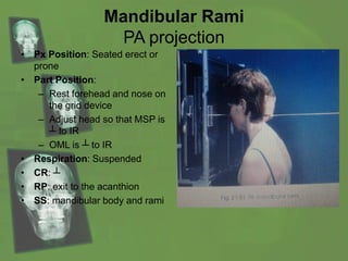 Mandibular Rami
PA projection
• Px Position: Seated erect or
prone
• Part Position:
– Rest forehead and nose on
the grid device
– Adjust head so that MSP is
┴ to IR
– OML is ┴ to IR
• Respiration: Suspended
• CR: ┴
• RP: exit to the acanthion
• SS: mandibular body and rami
 