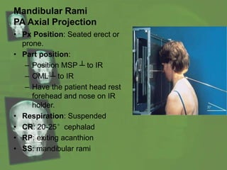 Mandibular Rami
PA Axial Projection
• Px Position: Seated erect or
prone.
• Part position:
– Position MSP ┴ to IR
– OML ┴ to IR
– Have the patient head rest
forehead and nose on IR
holder.
• Respiration: Suspended
• CR: 20-25°cephalad
• RP: exiting acanthion
• SS: mandibular rami
 