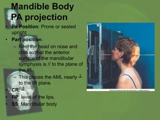 Mandible Body
PA projection
• Px Position: Prone or seated
upright
• Part position:
– Rest the head on nose and
chin so that the anterior
surface of the mandibular
symphysis is // to the plane of
the IR.
– This places the AML nearly ┴
to the IR plane.
• CR: ┴
• RP: level of the lips.
• SS: Mandibular body
 