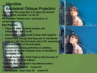 Mandible
Axiolateral Oblique Projection
The goal of this projection is to place the desired
portion of the mandible // to the IR.
Px Position: Seated erect, semisupine, or
semiprone.
Part Position:
• Place the head in lateral position with
interpupillary line ┴ to IR.
• Have patient close mouth & keep teeth together.
• Extend neck enough that long axis of mandibular
body is // with the transverse axis of IR, preventing
superimposition of cervical spine.
• If projection is being performed on tabletop,
position IR so that complete body of mandible is
positioned on IR.
• Adjust the rotation of the head so that the area of
interest is // to IR as follows:
1) ramus: keep the head in true lateral position;
2) body: rotate head 30° toward IR
3) symphysis: rotate head 45° toward IR.
 