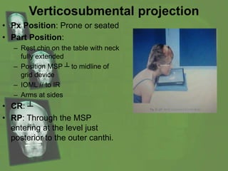 Verticosubmental projection
• Px Position: Prone or seated
• Part Position:
– Rest chin on the table with neck
fully extended
– Position MSP ┴ to midline of
grid device
– IOML // to IR
– Arms at sides
• CR: ┴
• RP: Through the MSP
entering at the level just
posterior to the outer canthi.
 
