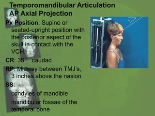Temporomandibular Articulation
AP Axial Projection
Px Position: Supine or
seated-upright position with
the posterior aspect of the
skull in contact with the
VCH.
CR: 35° caudad
RP: Midway between TMJ’s,
3 inches above the nasion
SS:
condyles of mandible
mandibular fossae of the
temporal bone
 